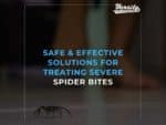 Safe & Effective Solutions For Treating Severe Spider Bites