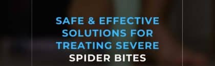 Safe & Effective Solutions For Treating Severe Spider Bites
